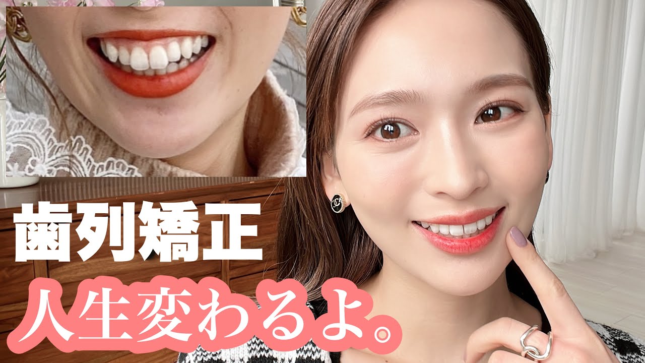 【歯列矯正】矯正して顔は変わる？本当にやってよかった🦷✨/経過/痛み/費用