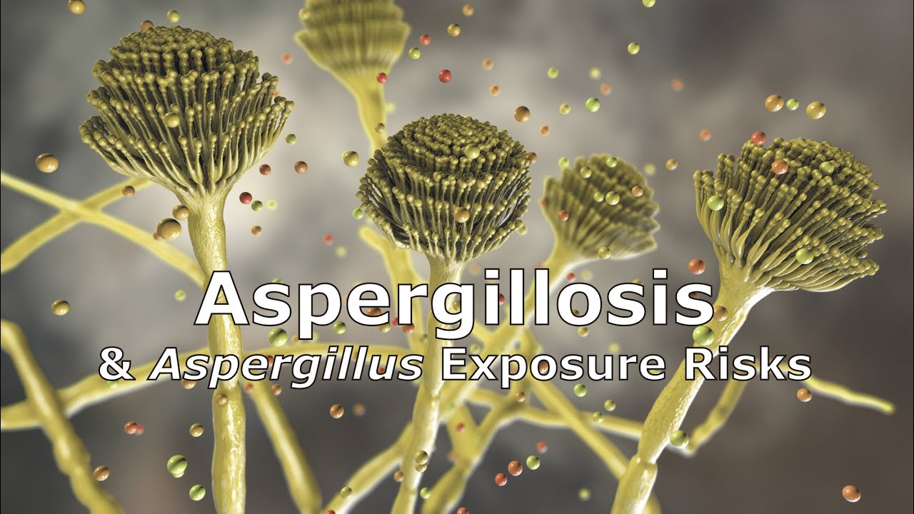 Aspergillosis and Aspergillus Exposure Risks