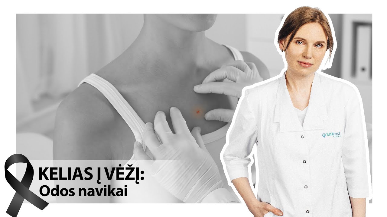 KELIAS Į VĖŽĮ: Odos navikai | Gydytoja onkodermatovenerologė, med. m. dr., Silvija Kontautienė