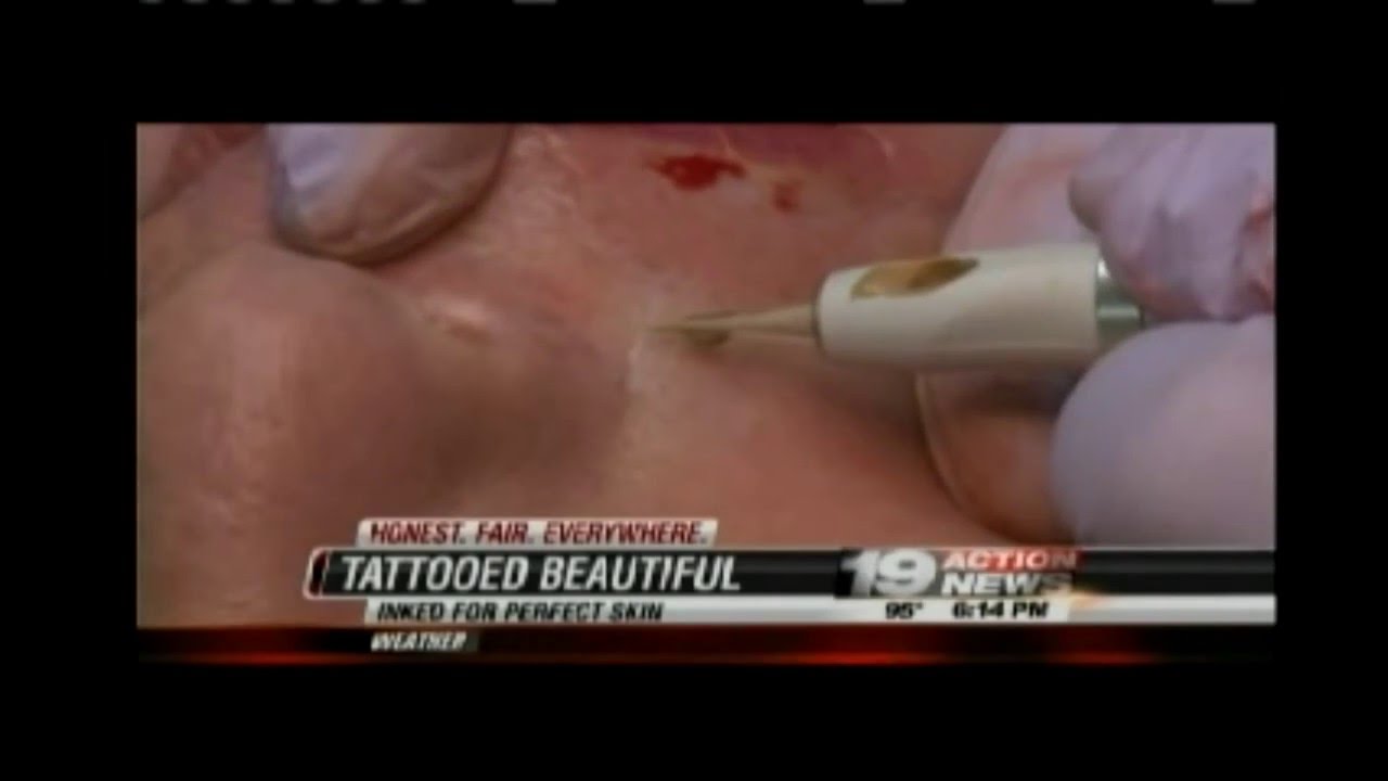 Scar Camouflage Procedures by Permanent Cosmetics Expert Jaudon Sunde