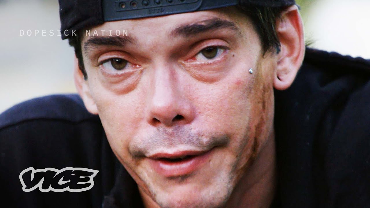How Scars Show the Struggles of Addiction | DOPESICK NATION