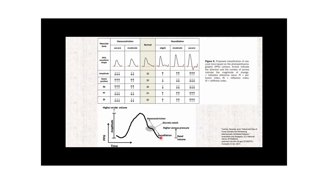 Oximetría de pulso