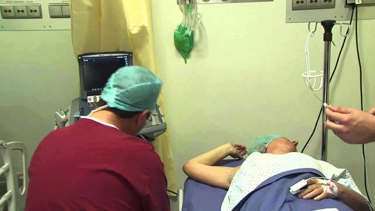 SICM news Dottor Albertin Ospedale San Giuseppe di Milano