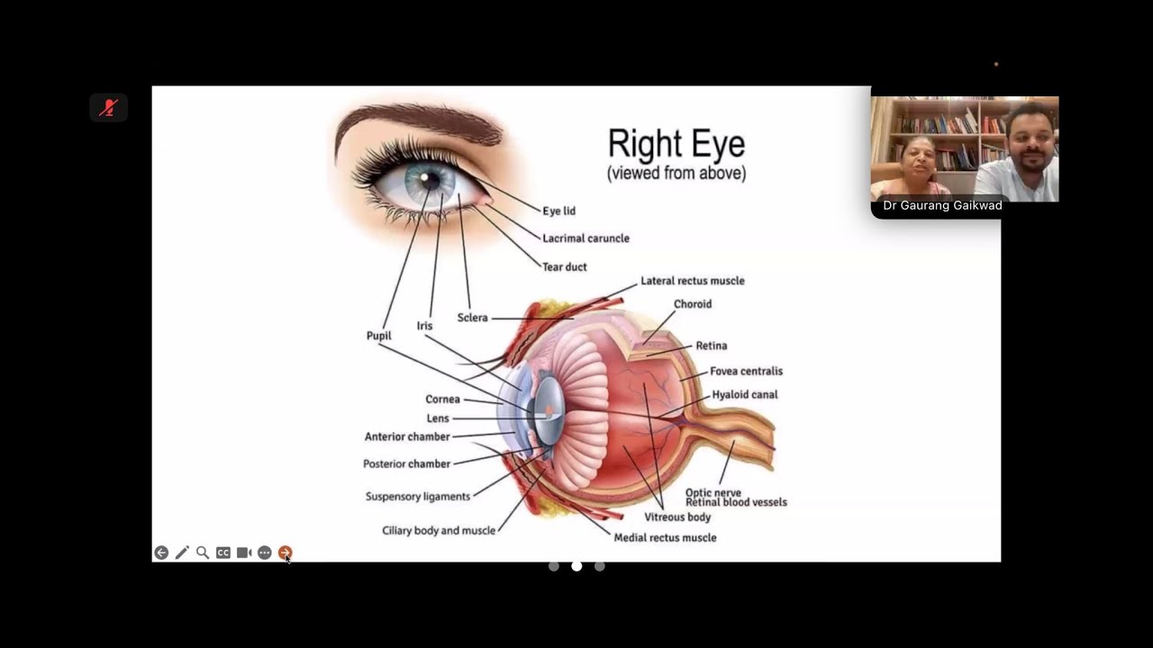 Case of Corneal Opacity cured by Homeopathy | Dr Pushpa Gaikwad & Dr Gaurang Gaikwad