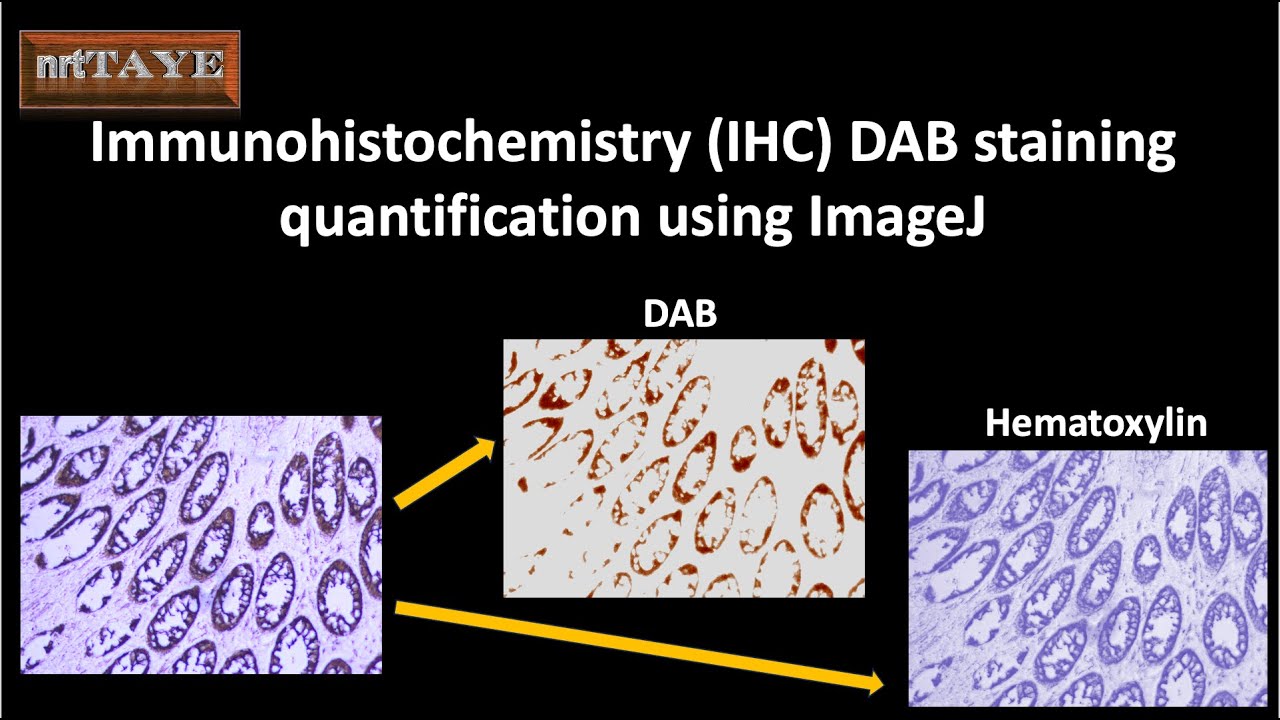 Иммуногистохимия (ИГХ) Количественная оценка окрашивания DAB с помощью ImageJ