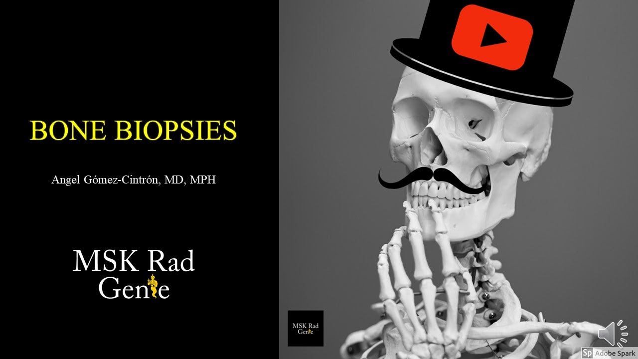 Image Guided Bone Biopsies