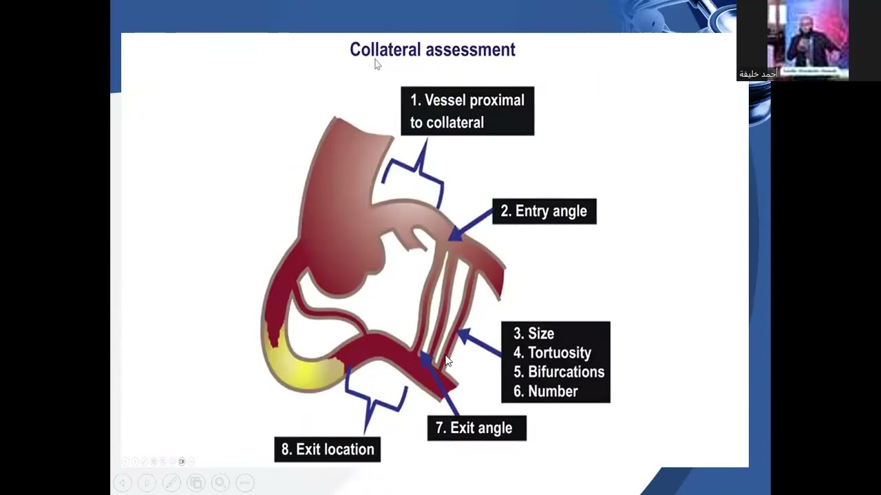 3 Retrograde via epicardial collaterals 1