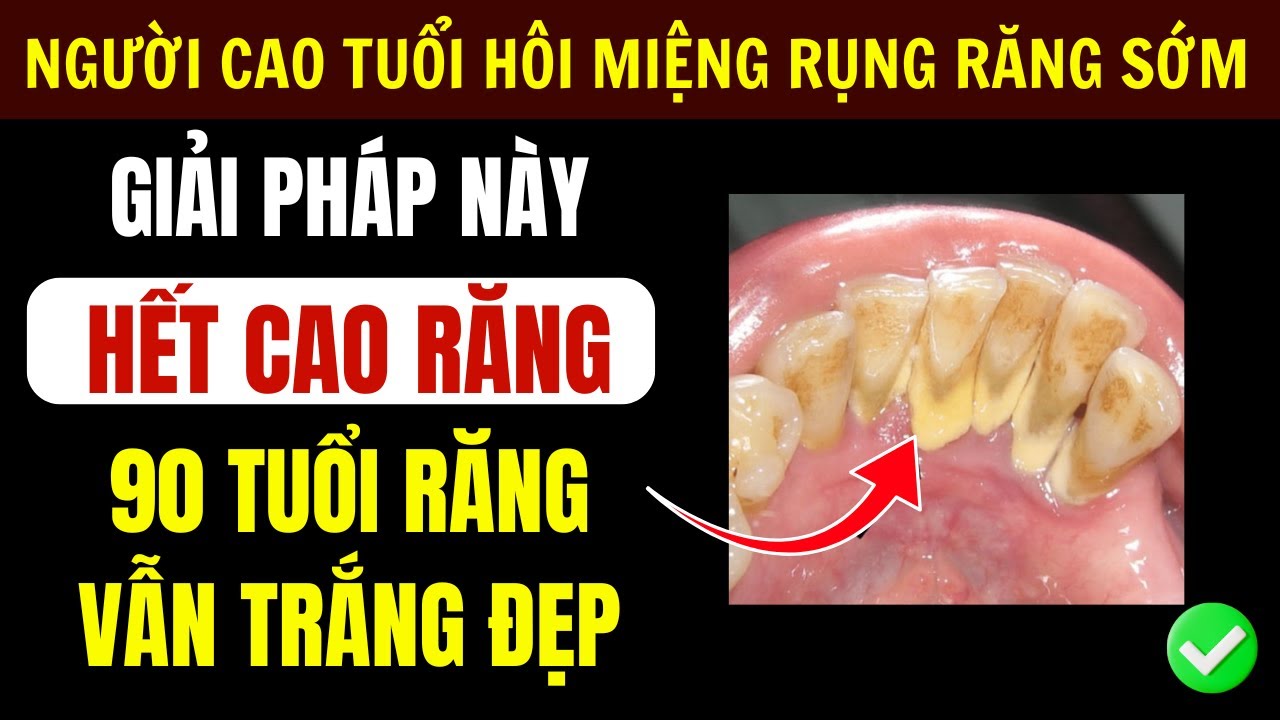 Hết Cao Răng Hôi Miệng Với Bí Quyết Tự Nhiên Tại Nhà - Răng Trắng Khoẻ Đến 90