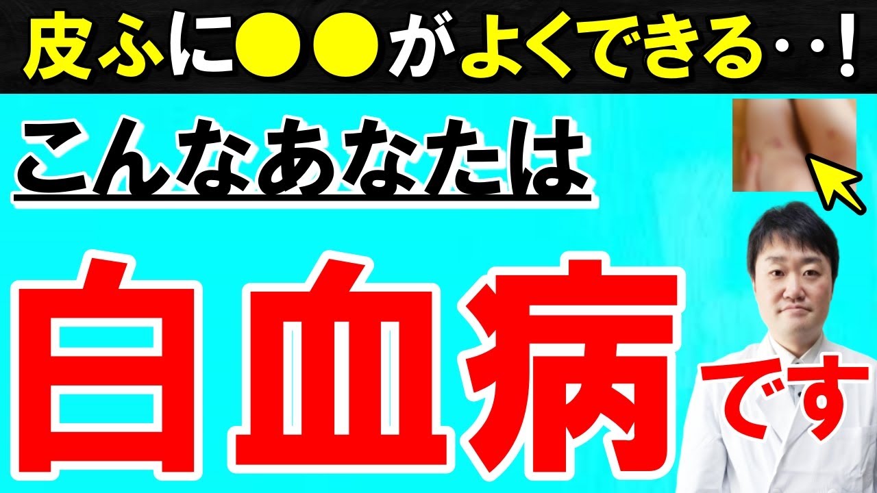 【放置禁止】見逃すと後悔する「白血病」の７つの初期症状　治療や実例も医師が解説