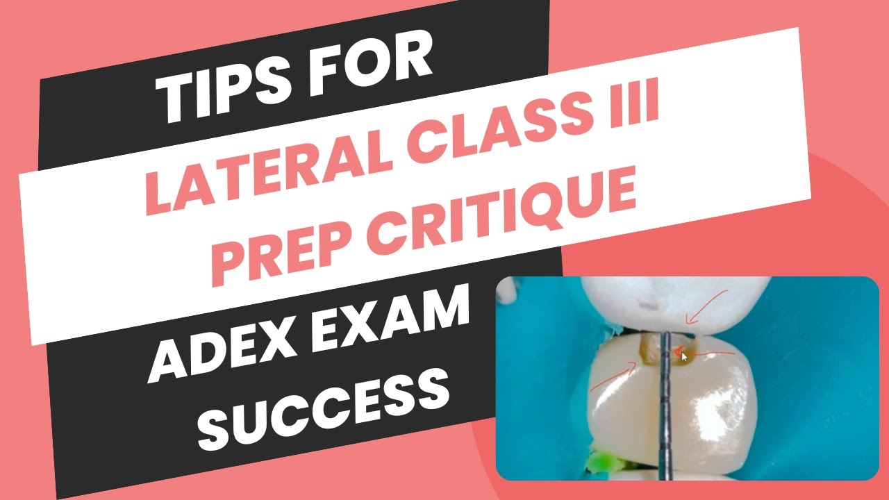 Lateral Class III Prep Critique Tips for ADEX Exam Success 🦷