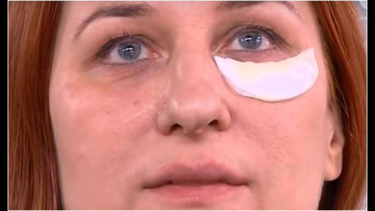 Ten naturalny sposób rozprawi się z workami pod oczami! [Dzień Dobry TVN]