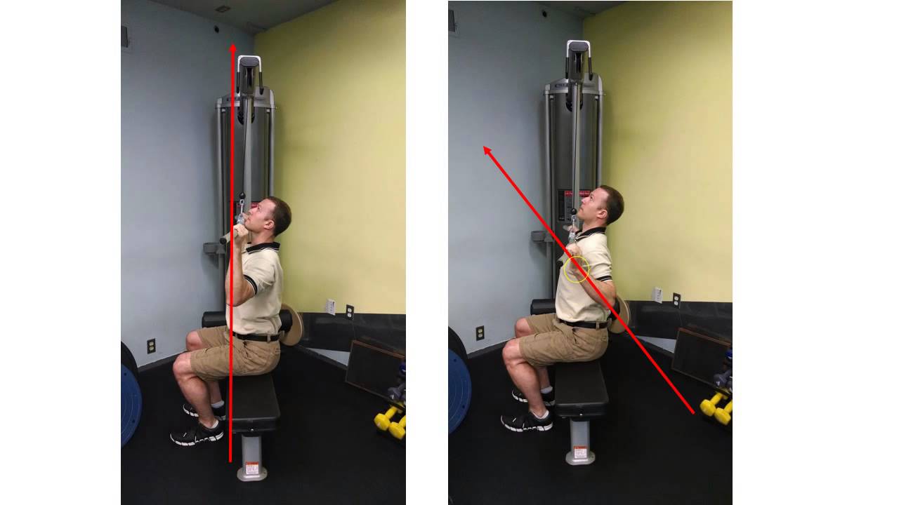 Lat Pulldown and Shoulder Impingement Risk