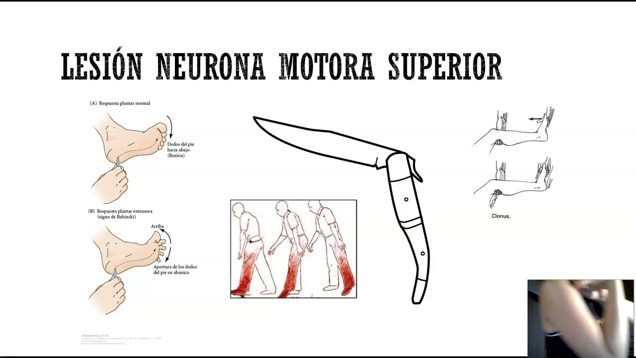 SNC Tema 18 Sistema motor