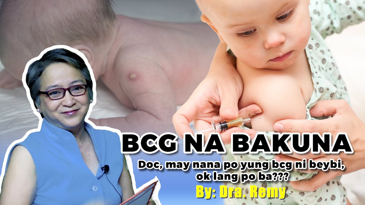 BCG NA BAKUNA