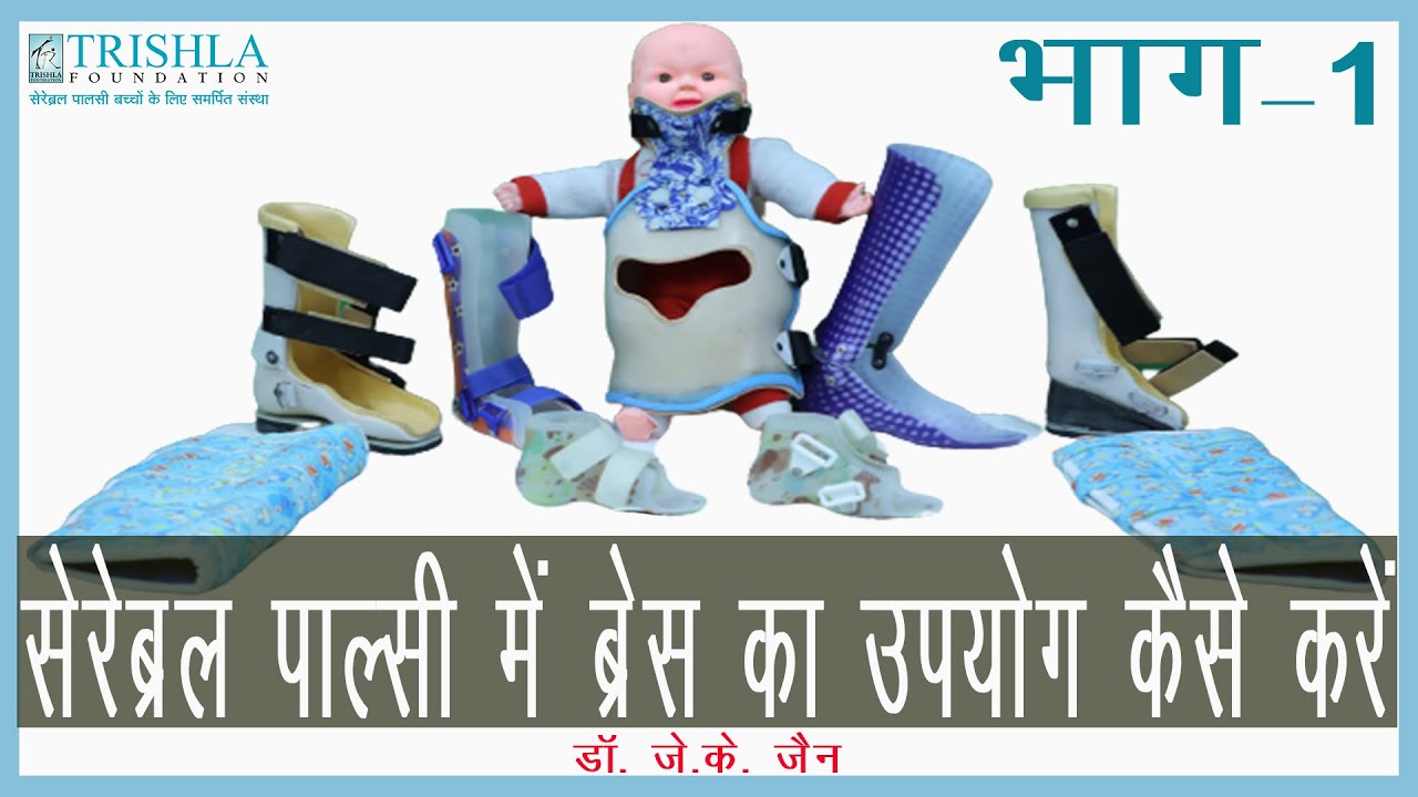 Cerebral Palsy: सेरेब्रल पाल्सी बच्चो में ब्रेस/ऑर्थोसिस/AFO/विशेष जूते की उपयोगिता एवं प्रकार भाग १