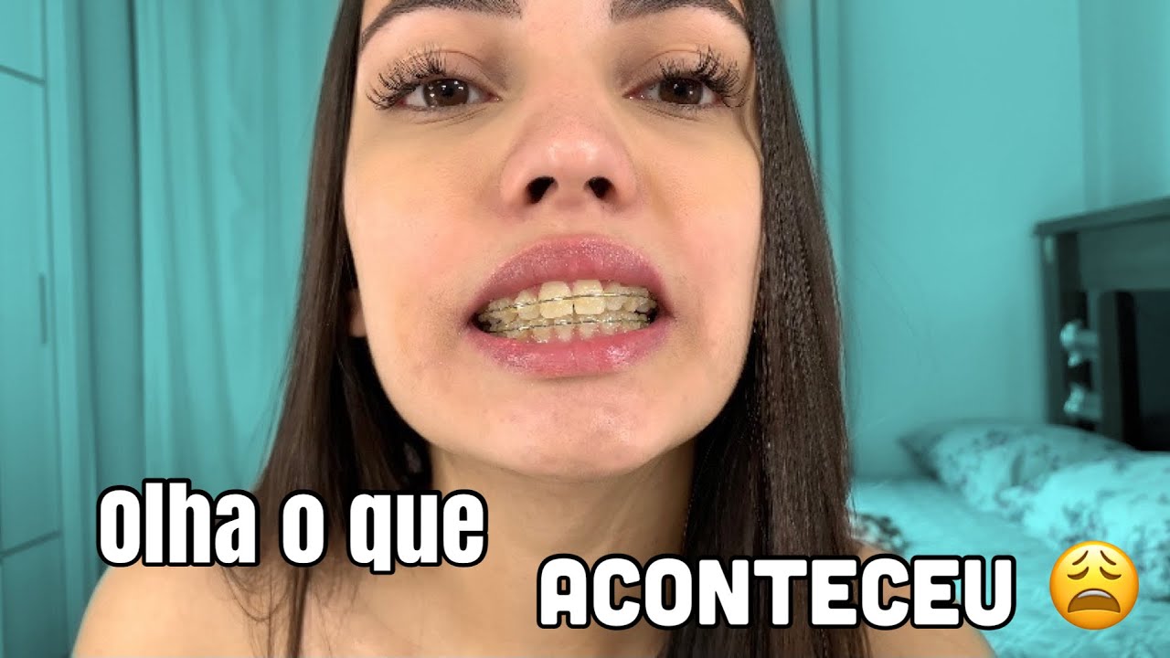 MINHA EXPERIÊNCIA COM APARELHO ESTÉTICO