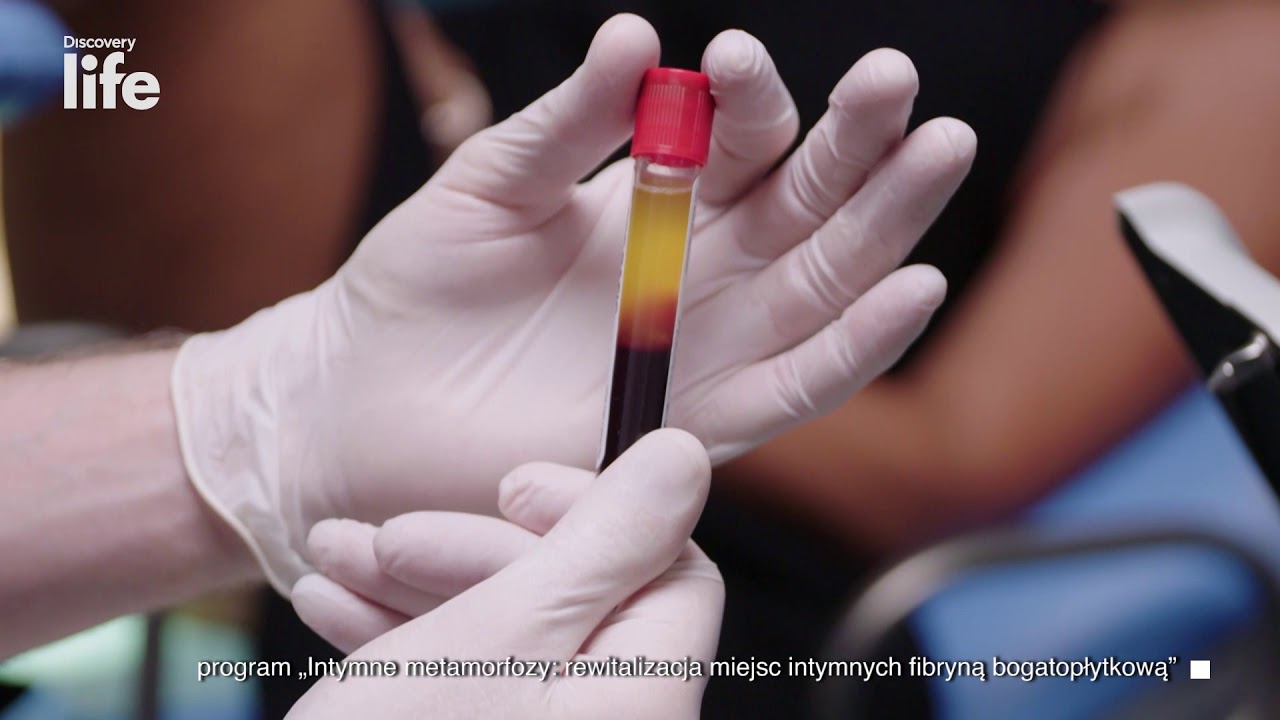 Fibryna bogatopłytkowa PRF BASIC w ginekologii.