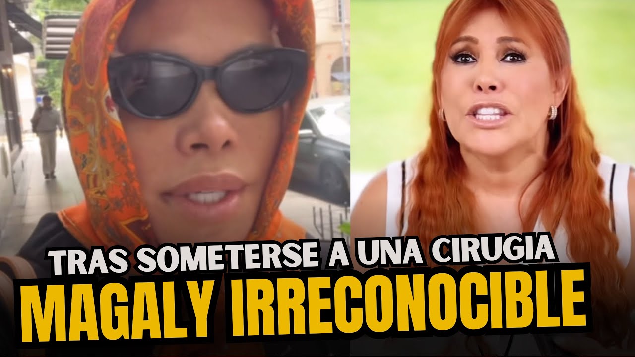 Magaly Medina reaparece y muestra su cambio tras someterse a cirugía facial en Argentina