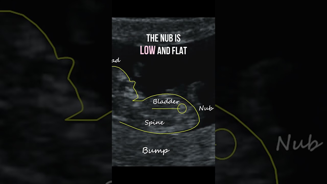Gender reveal with NubX!