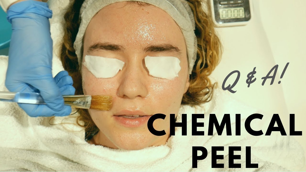 BERA PER HERE TE PARE PEELING KIMIK | Pyetjet tuaja !!