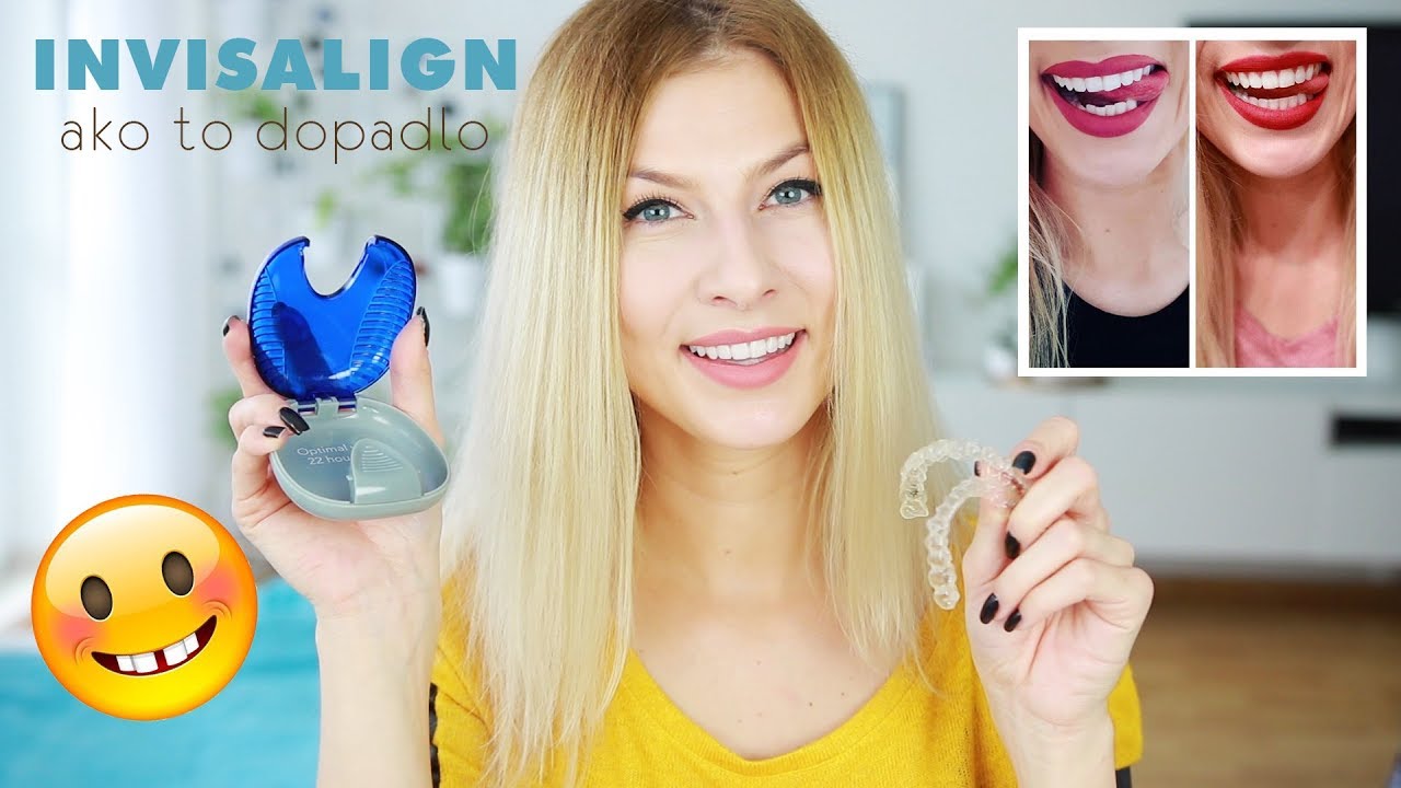 Invisalign - ako to dopadlo | Lenka