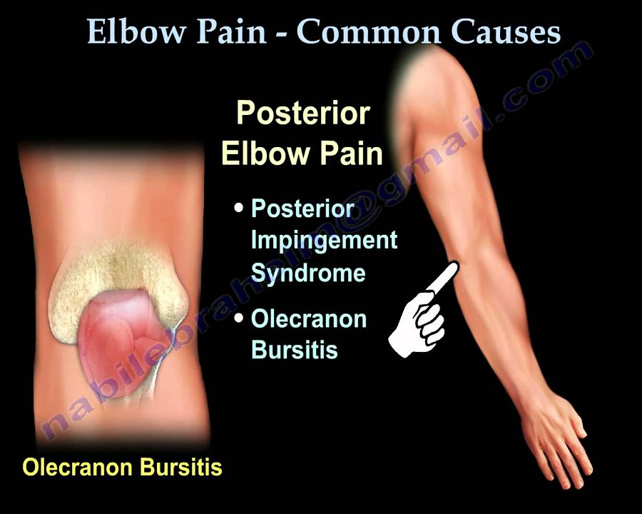 ELBOW PAIN , COMMON CAUSES - Everything You Need To Know - Dr. Nabil Ebraheim