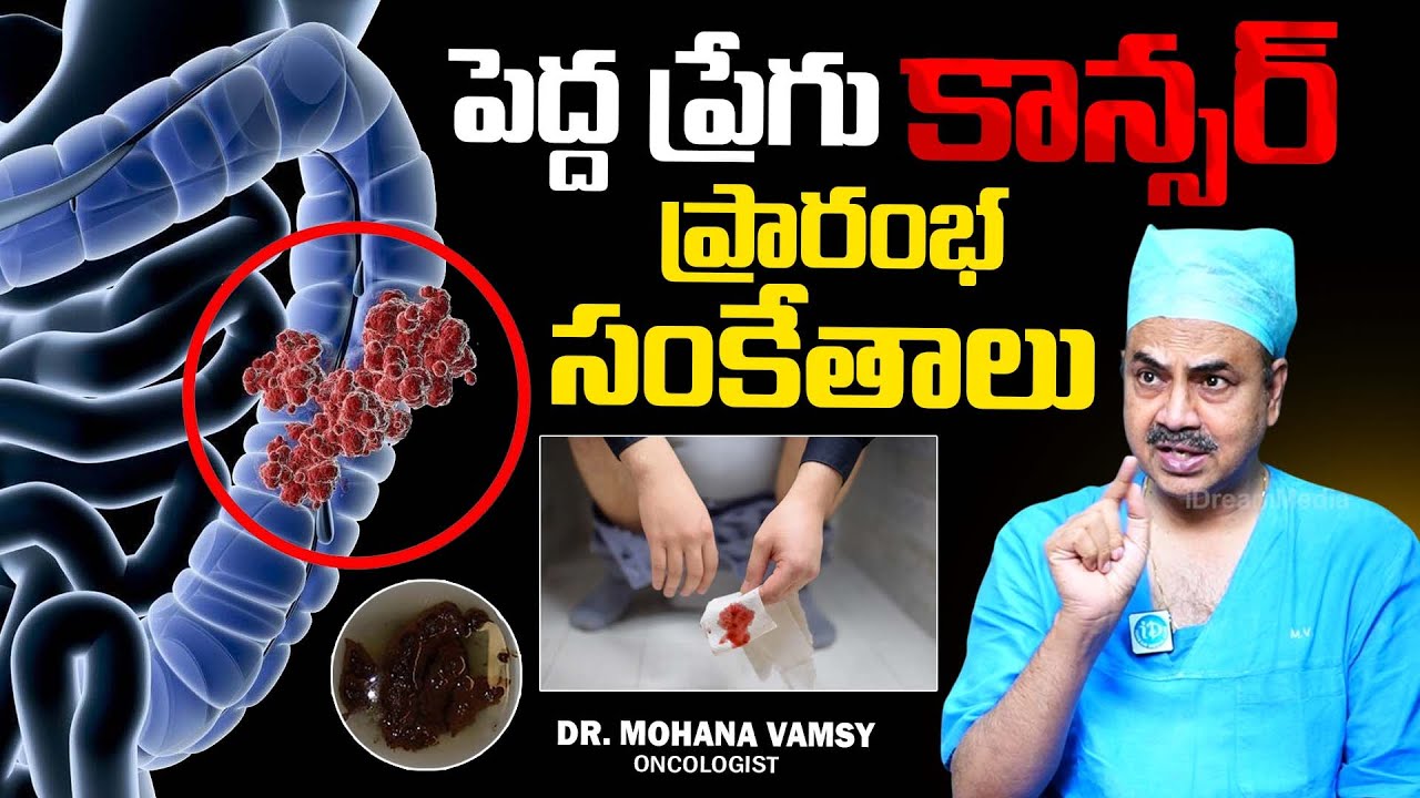పెద్ద ప్రేగు కాన్సర్ ప్రారంభ సంకేతాలు | Colon Cancer Symptoms in Telugu | Dr Mohana Vamsy |iD Health