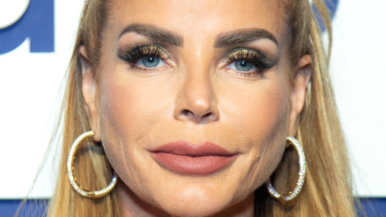 Real Housewives Stars Who Are Almost Unrecognizable Now