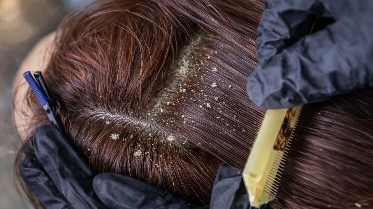 Gentle ASMR Scalp Wellness | Clean Hair Care Sounds for Relaxation & Focus