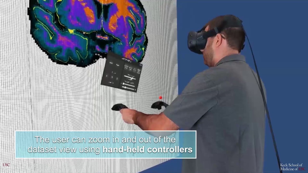VBS - Virtual Brain Segmenter