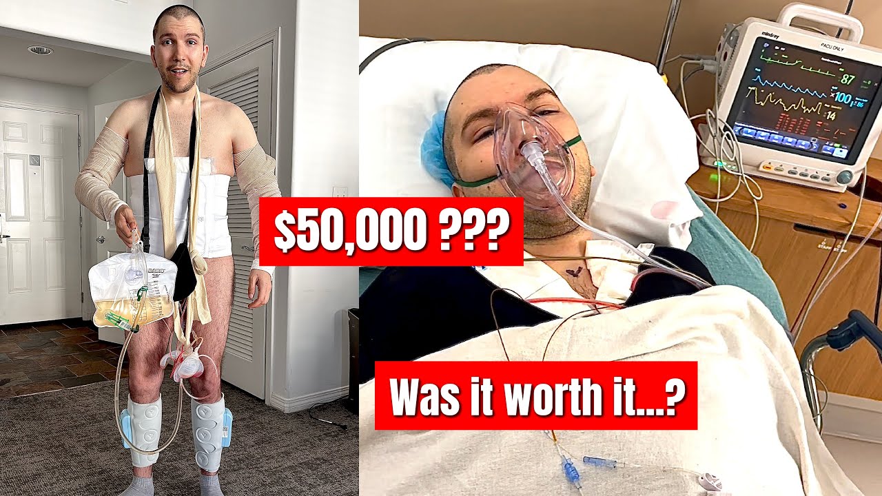 I Paid HOW MUCH for My Plastic Surgery?? (Tummy Tuck, Lipo, Body Lift, Arm & Thigh Lift)