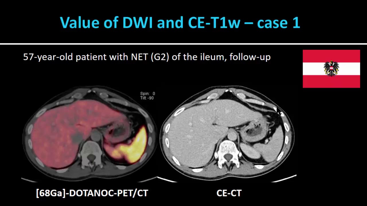 ISMRM MR Academy - Clinical PET/MRI: Workflow Considerations