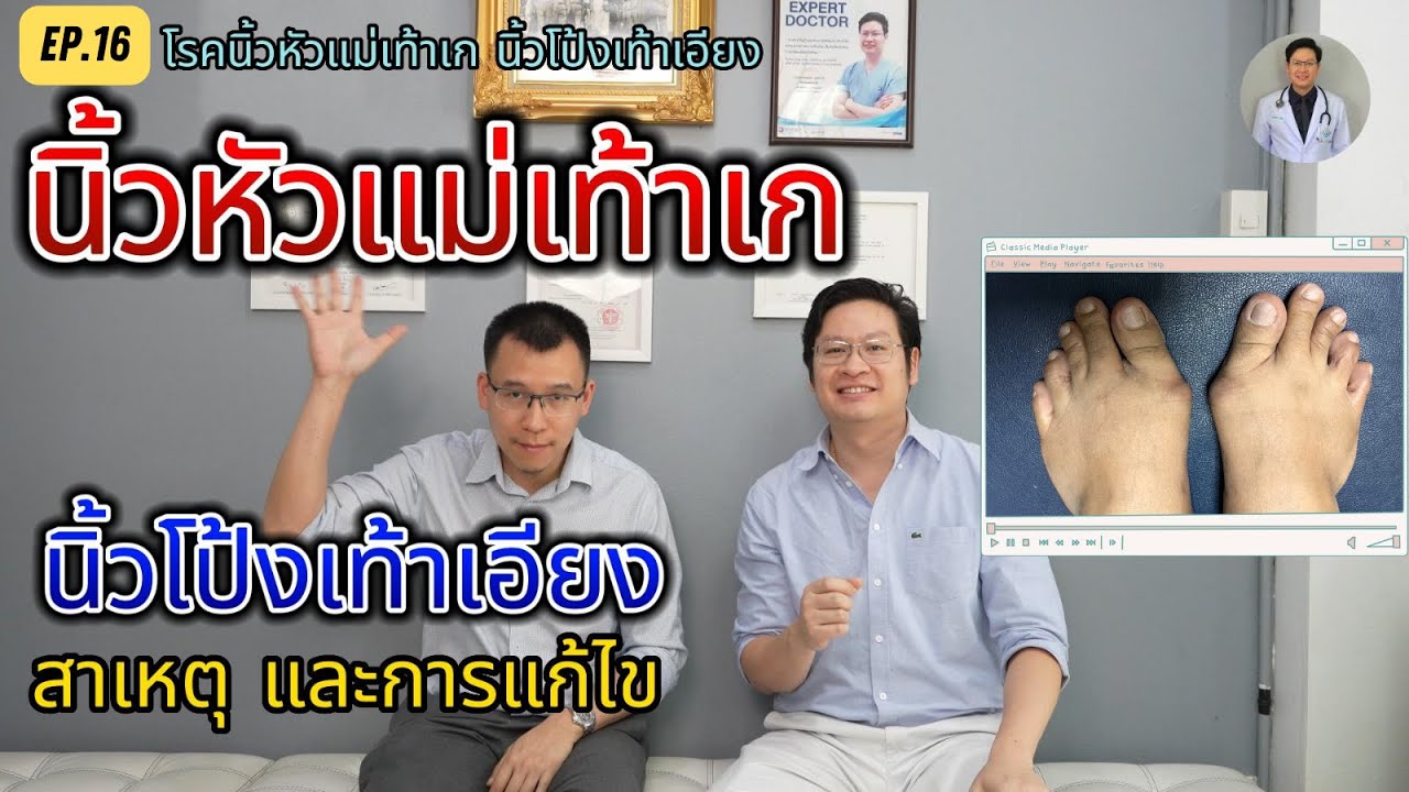 สาเหตุ และวิธีแก้ไข นิ้วหัวแม่เท้าเก นิ้วโป้งเท้าเอียง และสอนวิธีกายภาพได้ด้วยตัวเองที่บ้าน