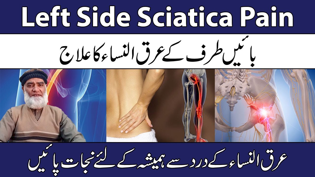 Left Side Sciatica Pain Treatment In Urdu | Araq Nisa Ka Gharelu Ilaj  | Al-Razaqi Health Recover
