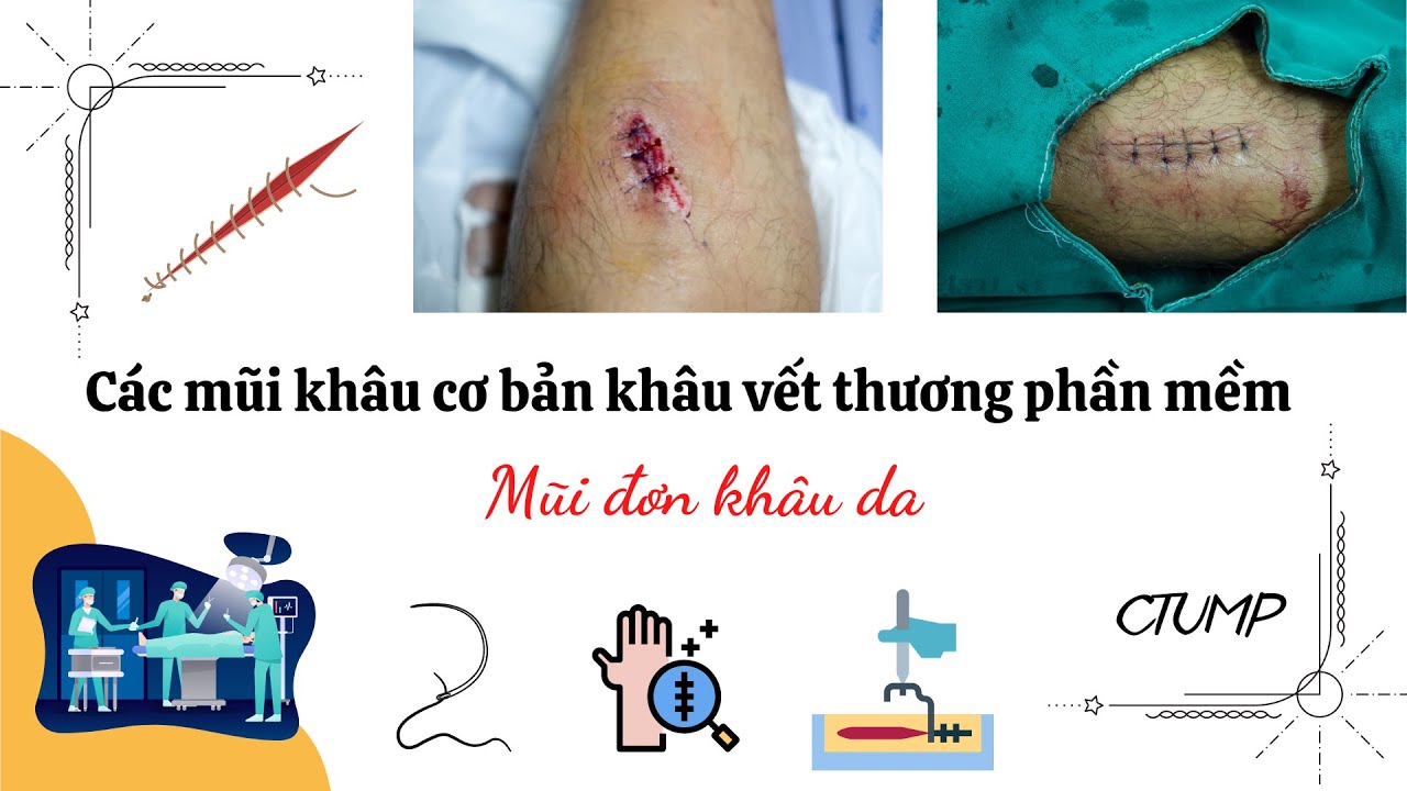 [PHẪU THUẬT THỰC HÀNH] - Thực hành: Khâu mũi đơn khâu da _ CTUMP.