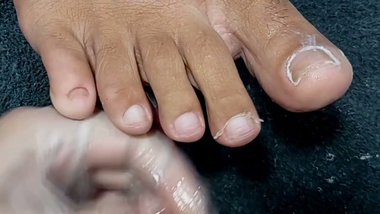 Veja a transformação desse pé -passo a passo completo. Pedicure e manicure .