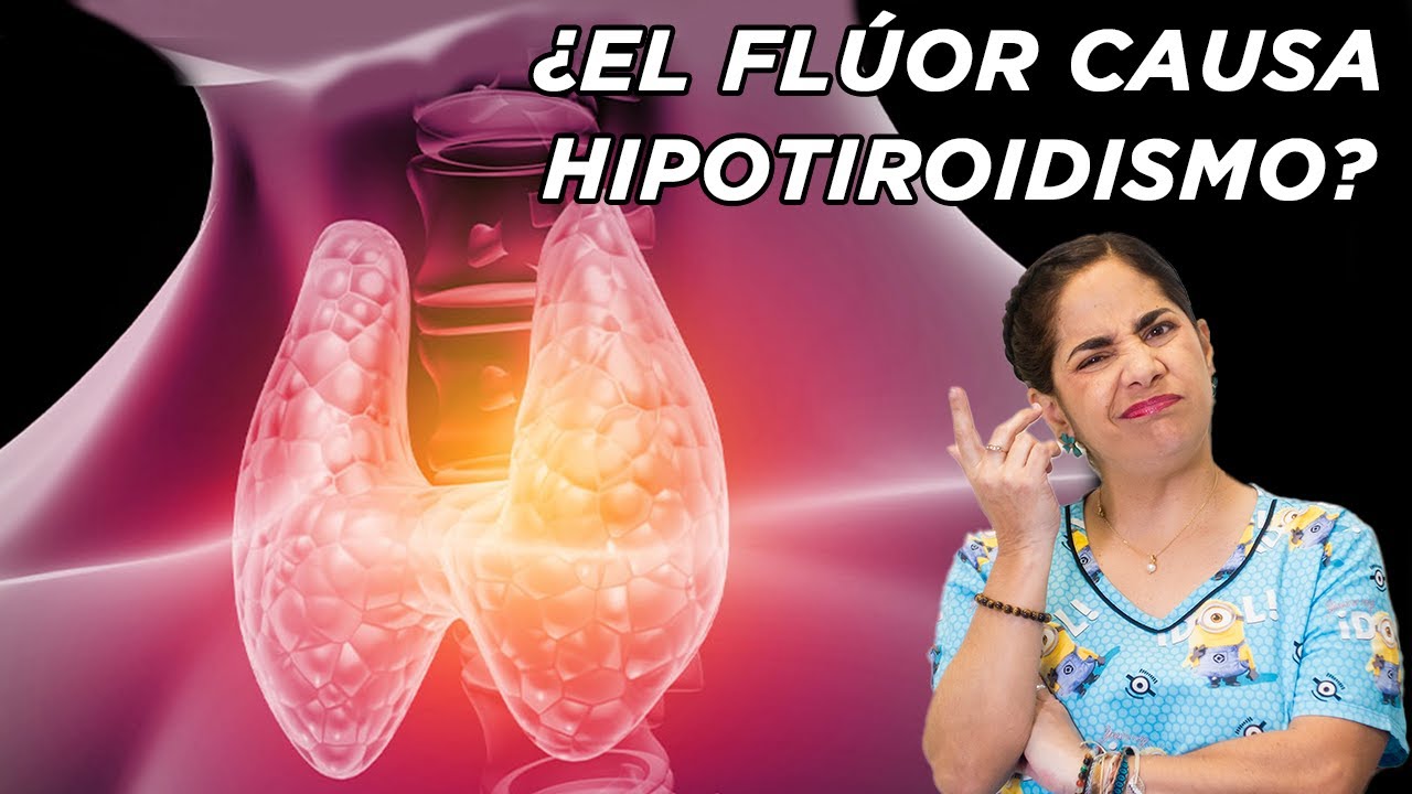 ¿El Flúor causa hipotiroidismo?