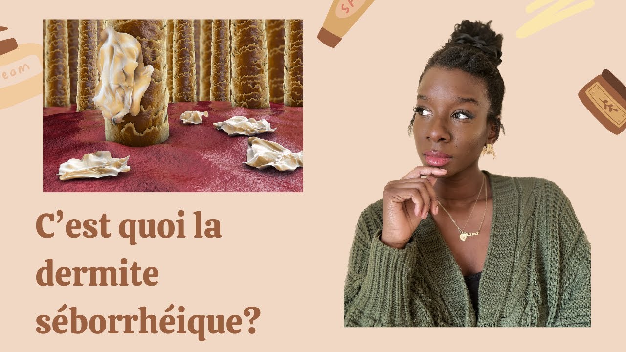Tout savoir sur la dermite séborrhéique: Les causes, comment traiter?...