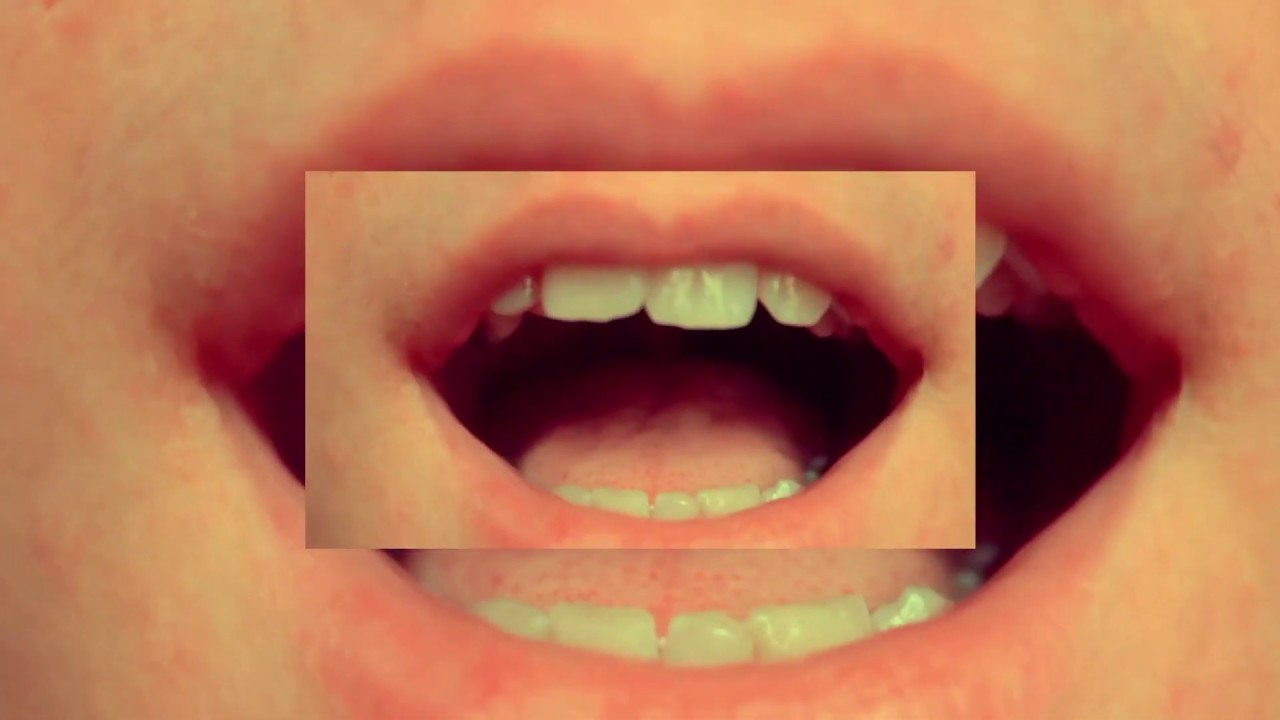 Jealous of the Birds - Young Neanderthal [Official Music Video]