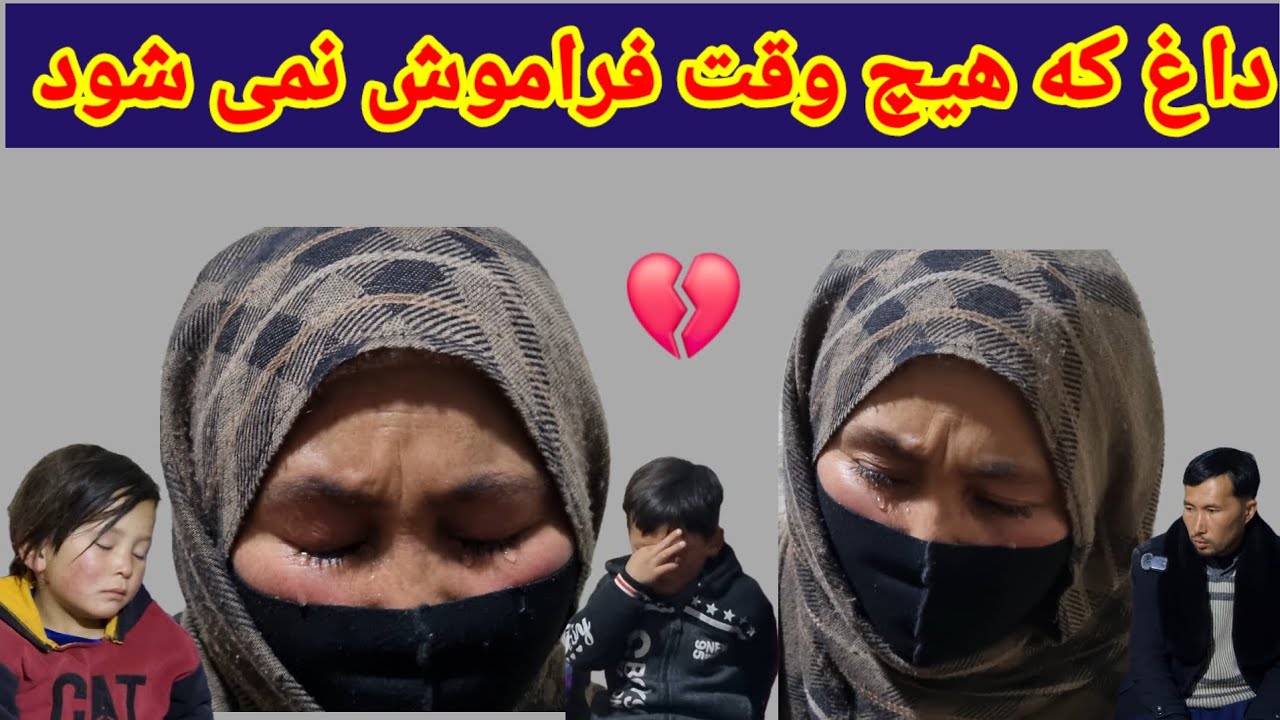 داغ که هیچ وقت فراموش نمی شود!😭