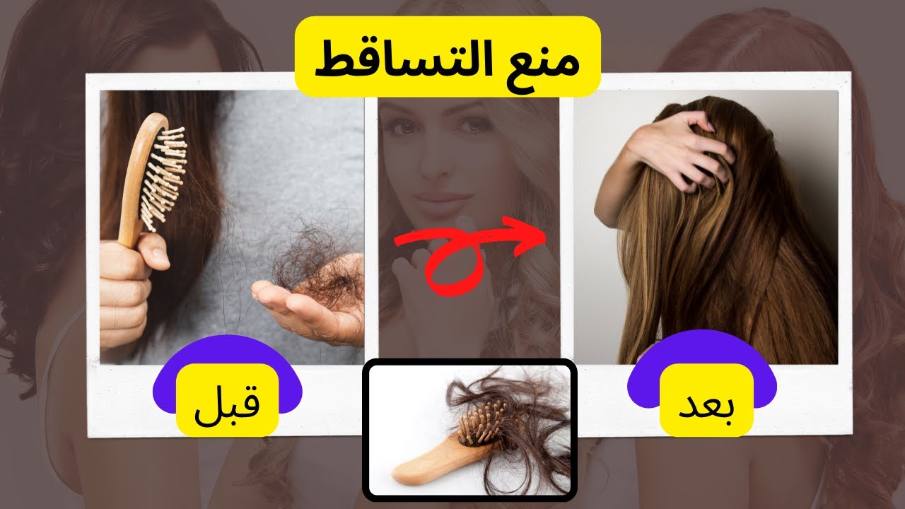 خلطة رهيبة لإنبات الشعر ومنع التساقط