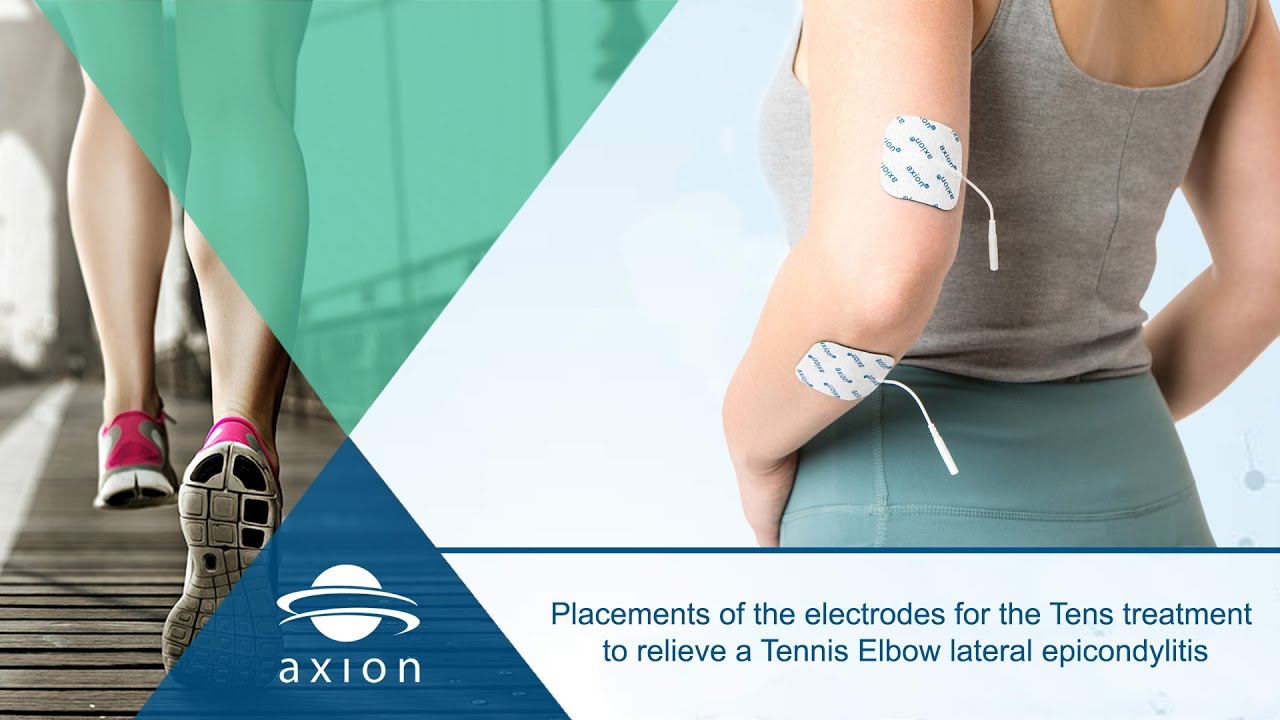 Tennis Elbow - Pad Placement For Electrical Stimulation TENS | axion