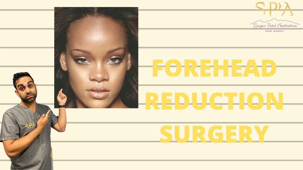 How to Make Your Forehead Smaller with Surgery