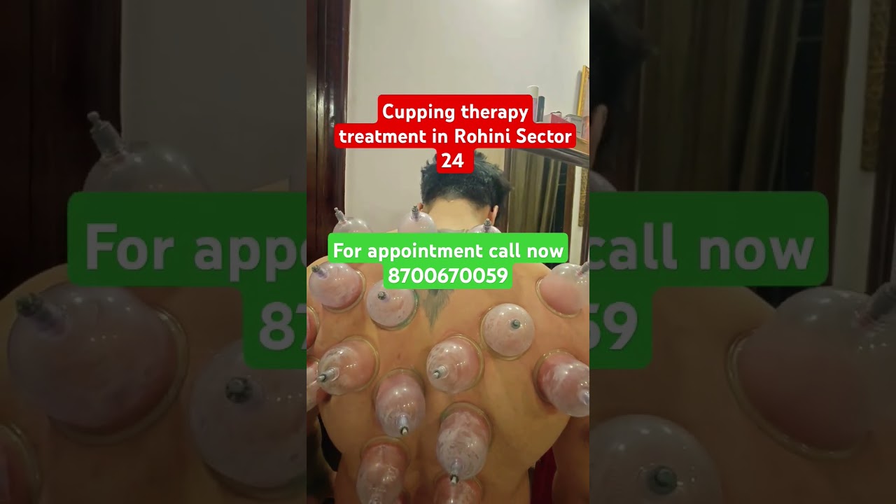 #neckpain #cuppingtherapy #dkps #motivation #physiotherapy #health #shortsviral #shortsvideo