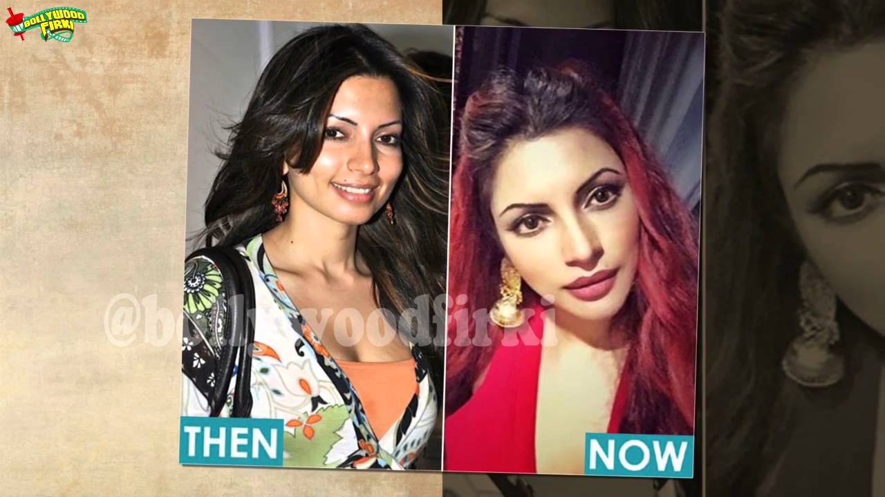 Shama Sikandar Gets Gorgeous Look From Cosmetic Surgery