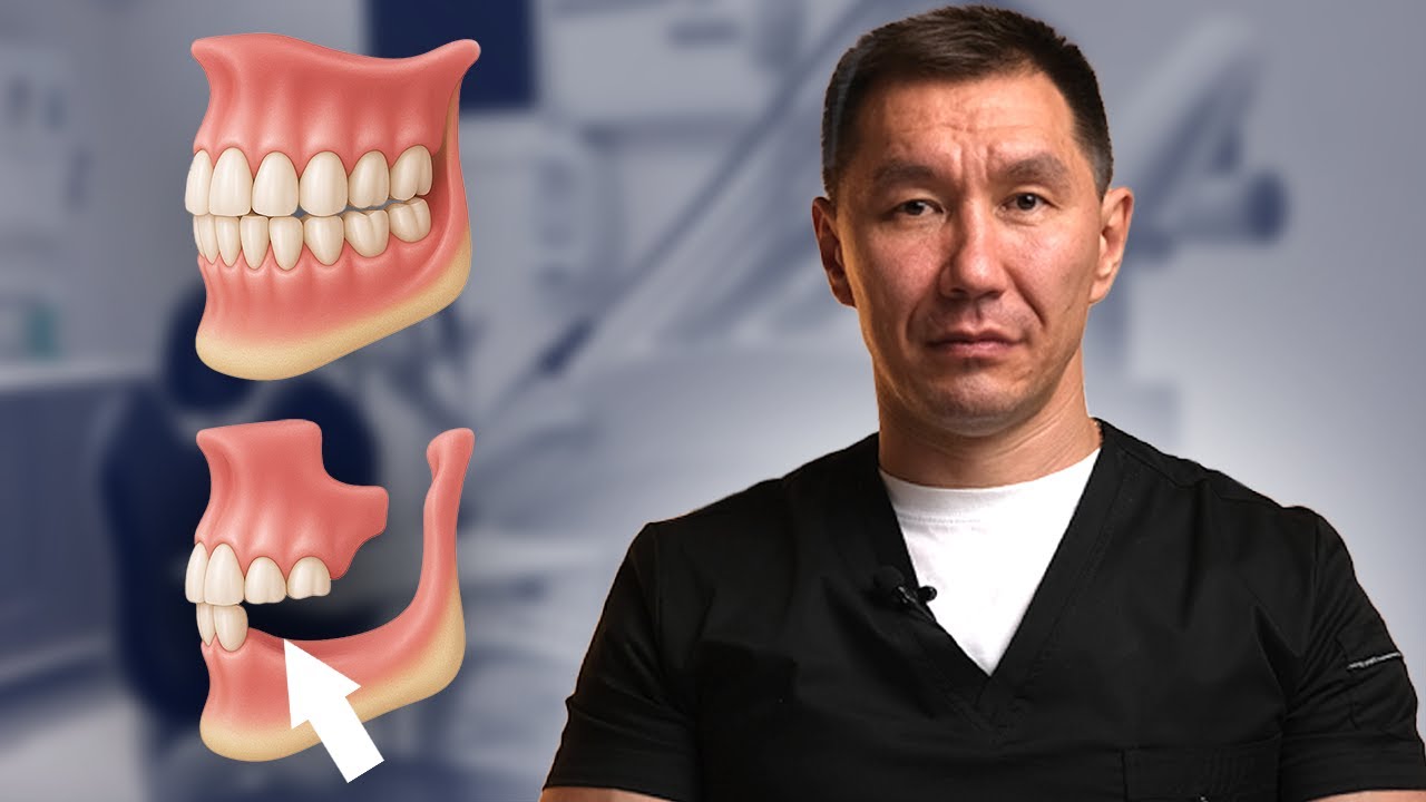 Lost a Chewing Tooth? DO THIS to Save Your Other Teeth
