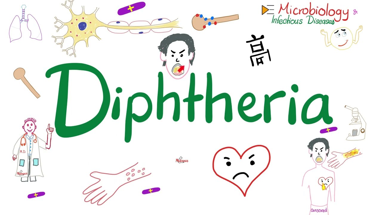 Diphtheria - Pseudomembranous pharyngitis, Myocarditis, Neuropathy - Microbiology 🧫