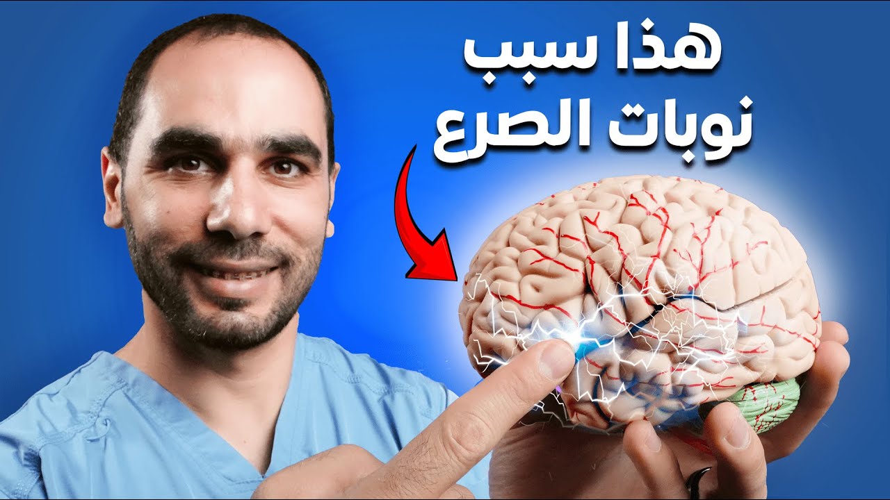 طبيب الدماغ يشرح السبب الحقيقي والعلاج الفعال للصرع