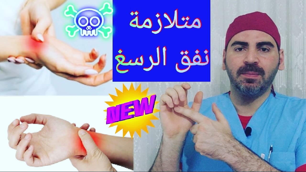 متلازمة النفق الرسغي carpal tunnel syndrome