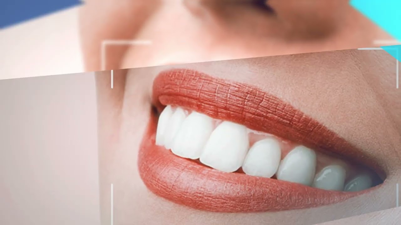 Adel Dental Clinic | Dental Clinic Turkey | Dental Holiday | Dentist